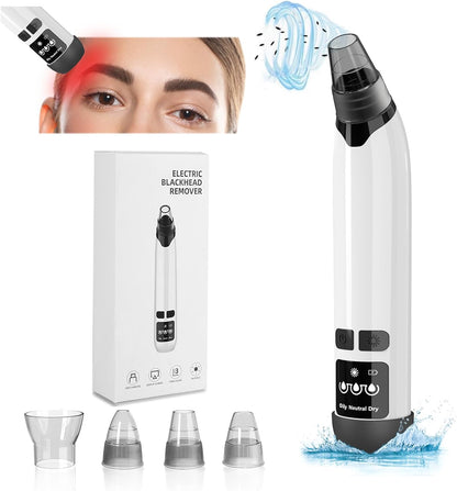 ✨ Advanced Blackhead Remover with Heating & Smart Suction Control